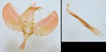 Yponomeuta cagnagella mâle AG-384 Miteu Martine Genneton 79 12072021 {JPEG}