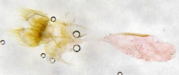 Cnephasia cupressivorana femelle AG-146 {JPEG}