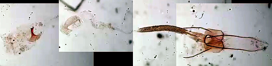 899_246405_Coleophora glaucicolella femelle AC-8681 {JPEG}